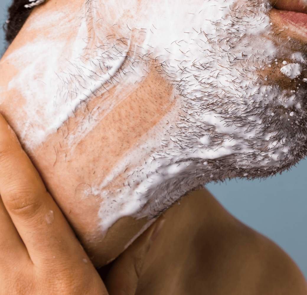 Man with shaving cream showing razor bumps on his neck.