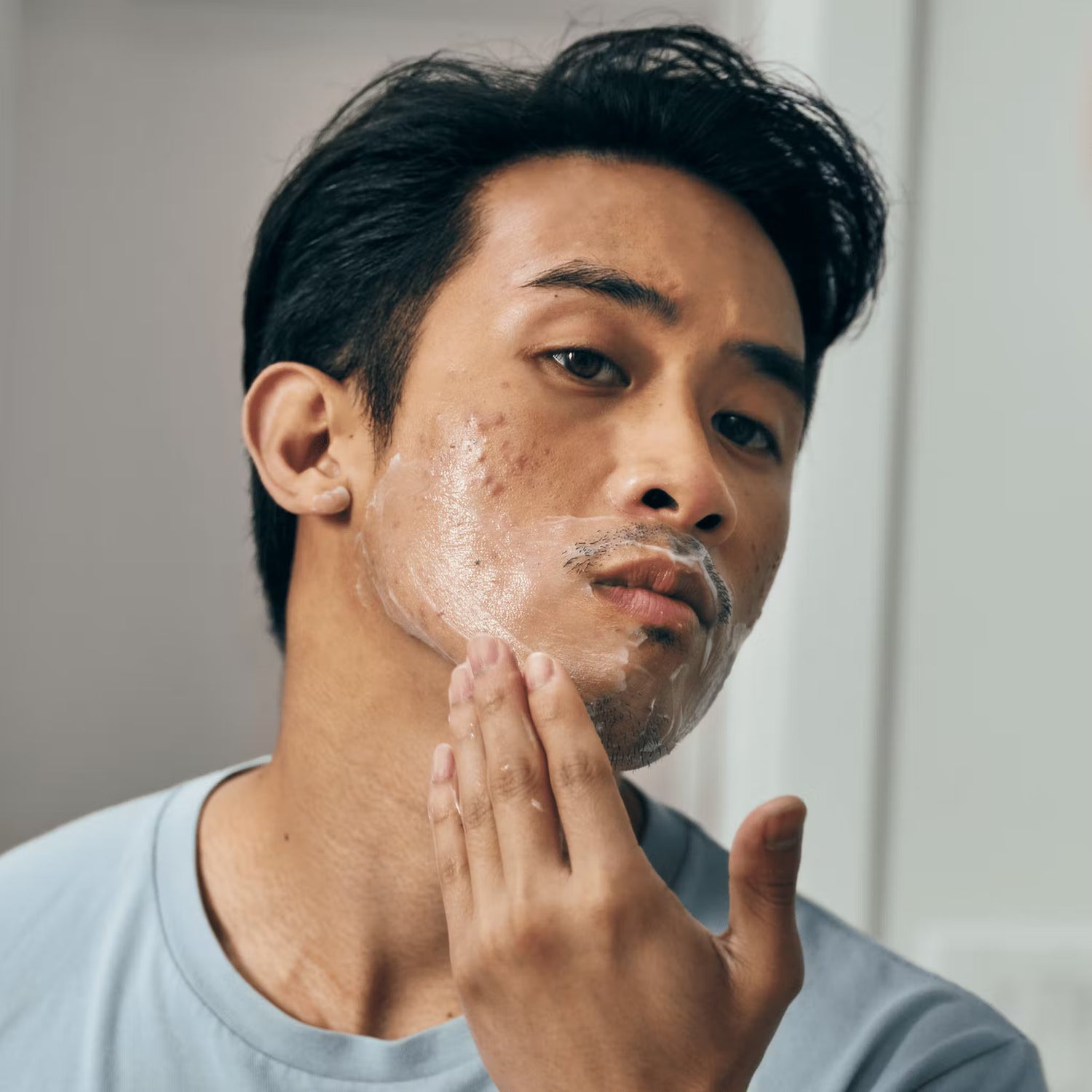 man with acne applying a shave aid cream to his face