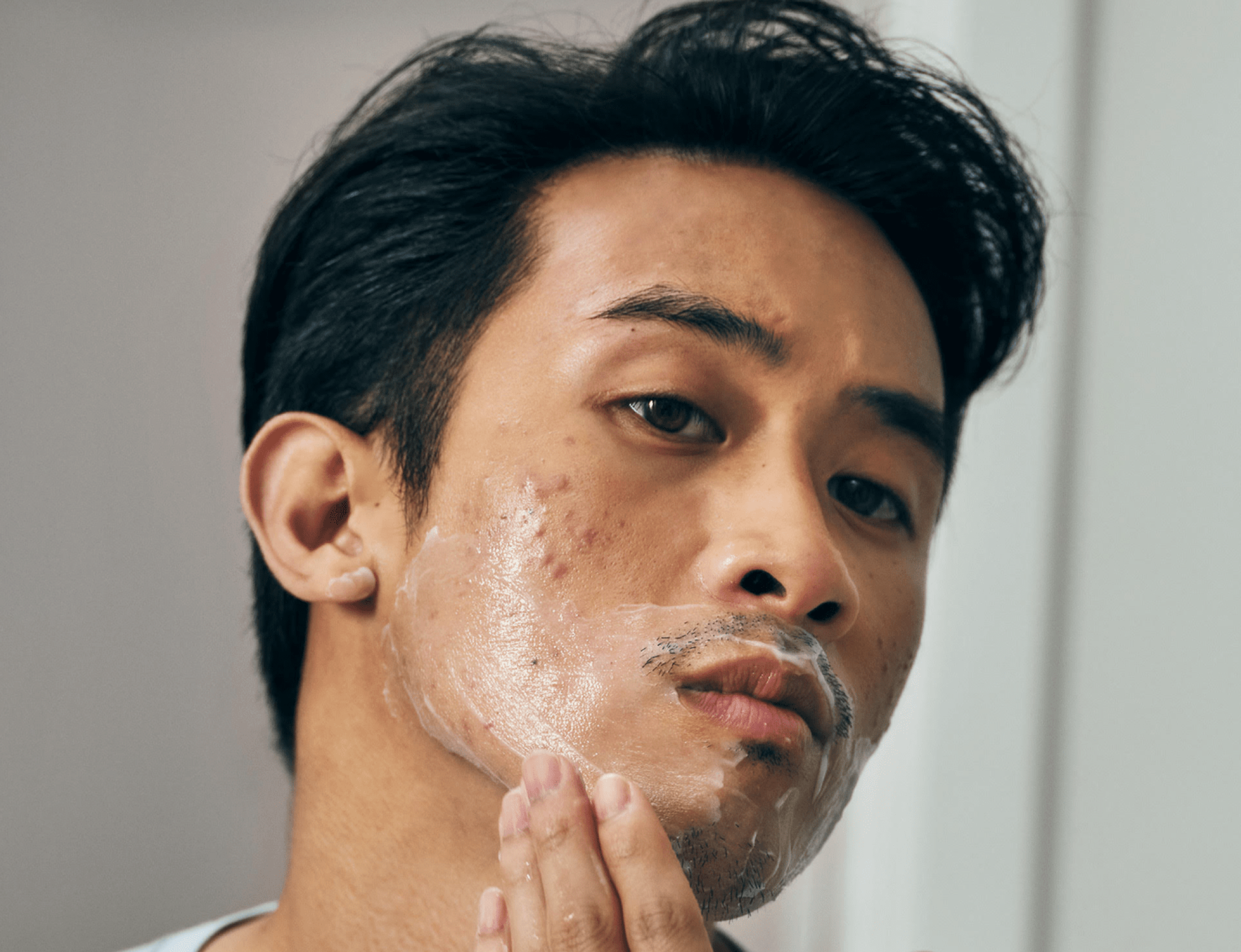 Image of Man Shaving With Acne.